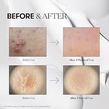 أمبولة VT ريدل شوت100