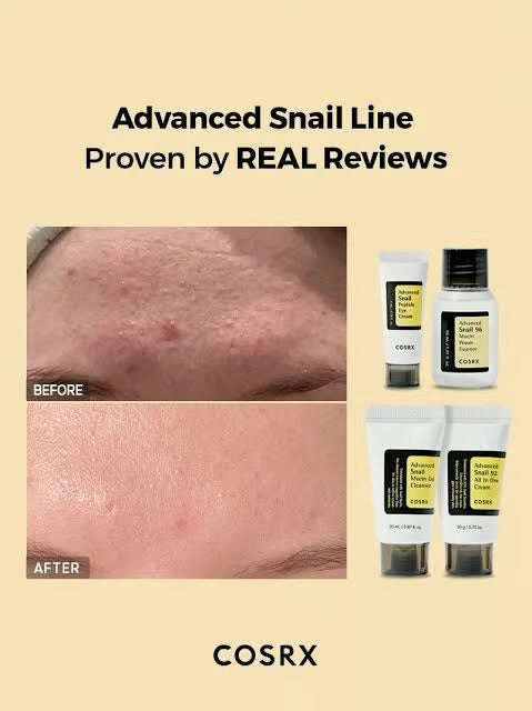 طقم مجموعة كوزركس Advanced Snail Trial